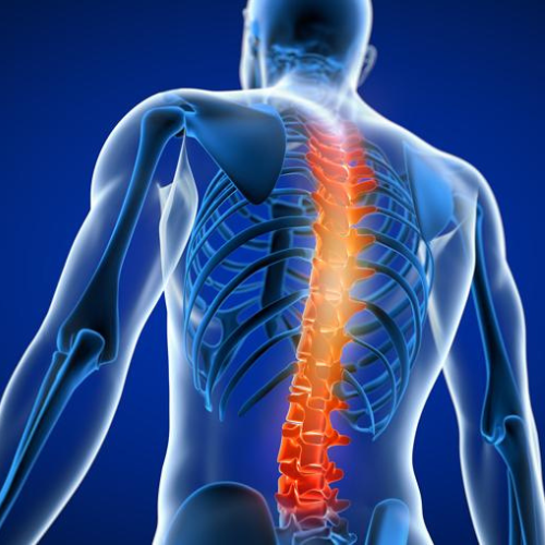 Back Pain