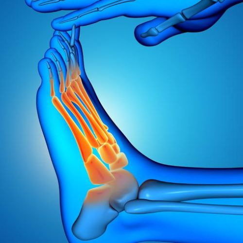 Foot Pain
