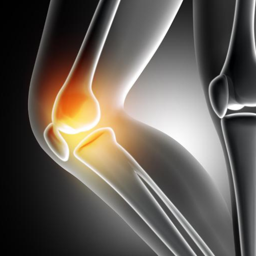 Knee Pain