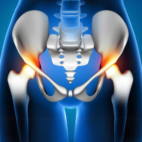 Pelvis Pain