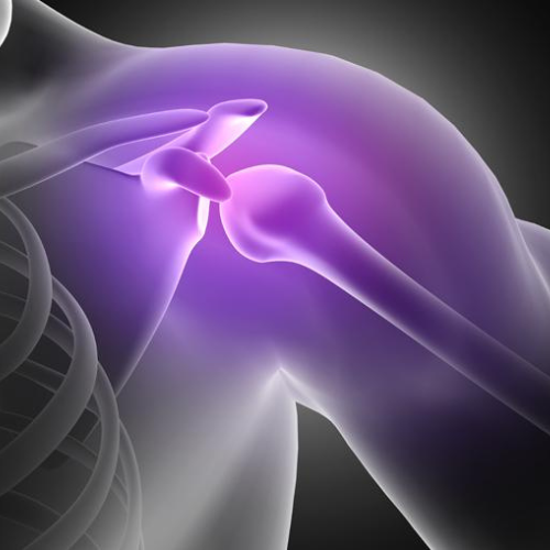 Shoulder Pain
