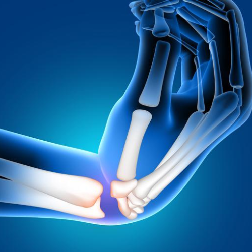Wrist Pain