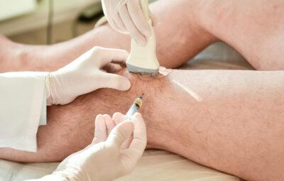 Comprehensive Dextrose Prolotherapy